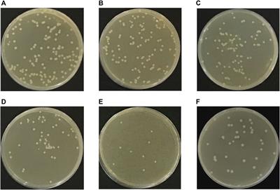 Mechanical and Antibacterial Properties of h-BN-TiO2 Nanocomposite-Modified Glass Ionomer Cement